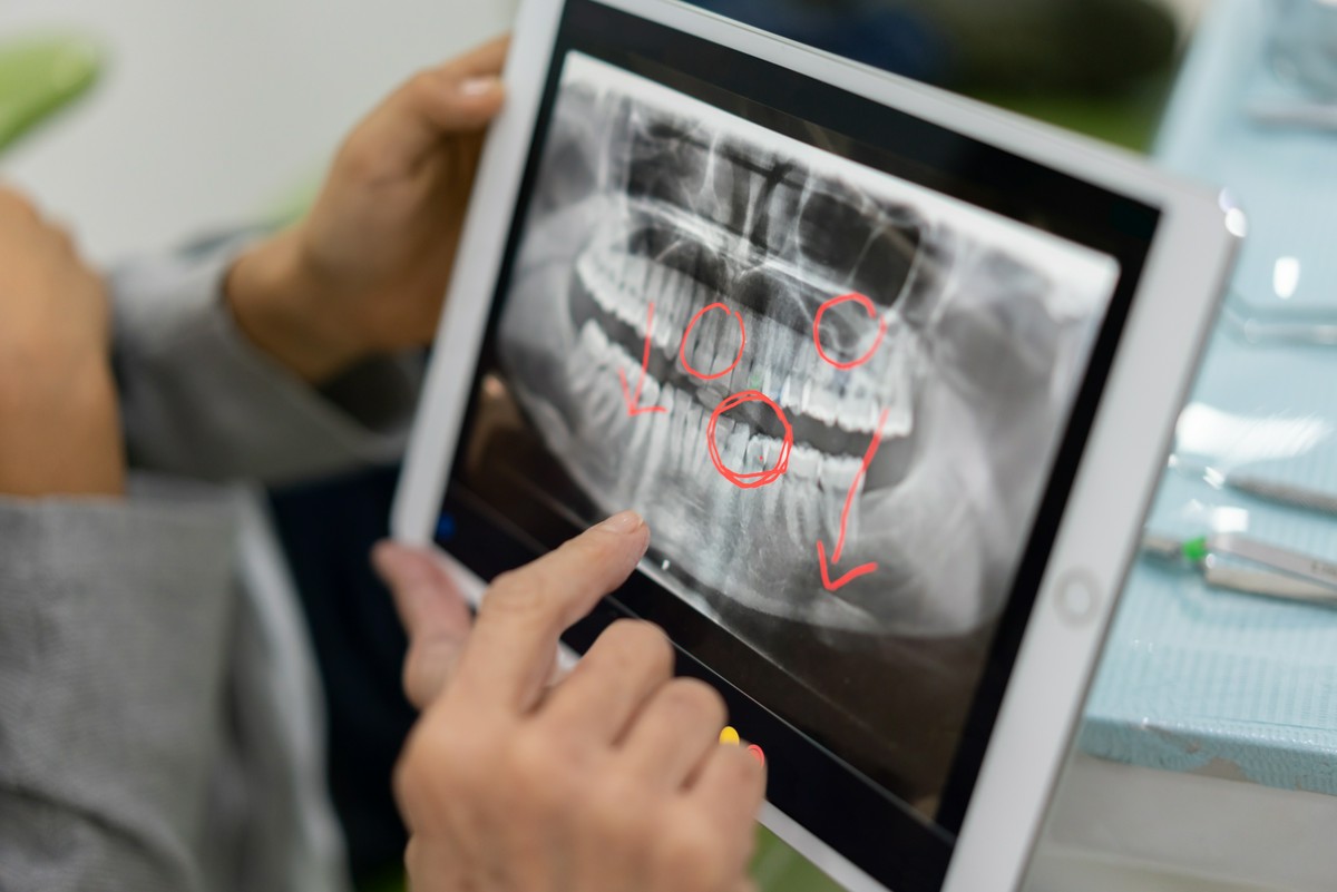 Czym jest RTG cefalometryczne?